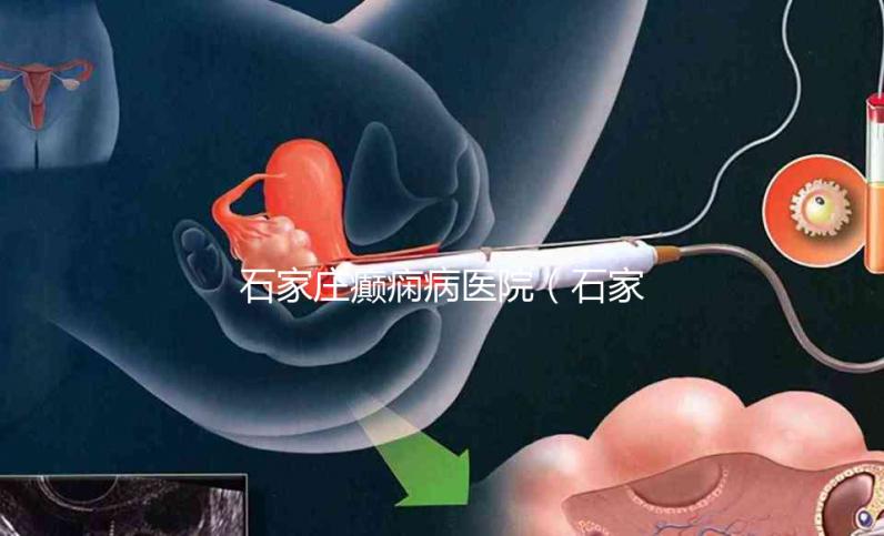 石家莊癲癇病醫(yī)院（石家莊治癲最厲害三個醫(yī)院）