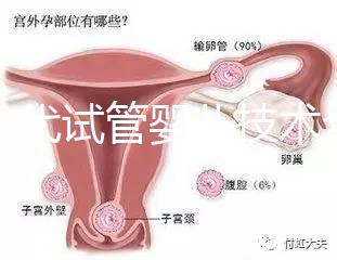 第一代試管嬰兒技術全解析：流程、適應癥及優缺點指南