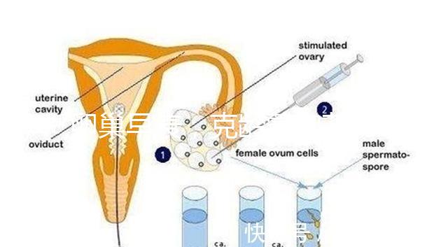 卵巢早衰，克齡蒙和芬嗎通藥物選擇引爭議