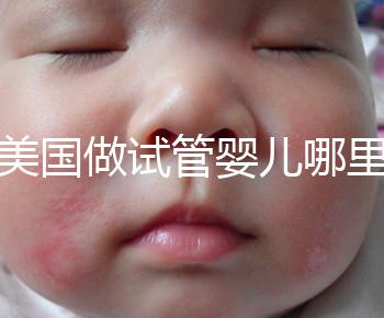 去美國做試管嬰兒哪里最好，4家好評輔助生殖機(jī)構(gòu)推薦