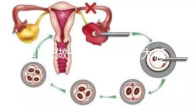 北京做一次試管嬰兒大概花多少錢？2025年價格及明細(xì)清單一覽！