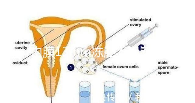 內(nèi)膜13mm凍胚不易著床要注意，移植與否看醫(yī)生怎么說