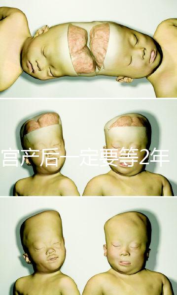 剖宮產(chǎn)后一定要等2年，才能試管嬰兒懷孕嗎？