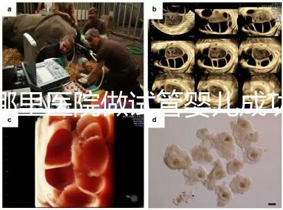 哪里醫院做試管嬰兒成功率高（一代試管成功率有多高）