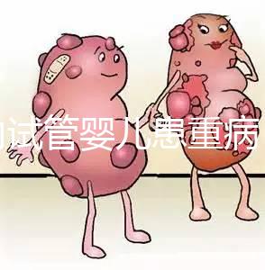 國內試管嬰兒患重病 試管是否存在健康隱患？