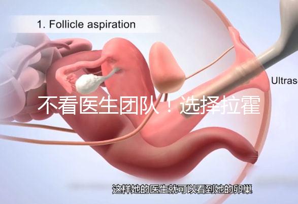 不看醫(yī)生團隊！選擇拉霍亞試管嬰兒中心的優(yōu)勢還有這些