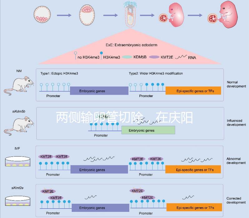 兩側輸卵管切除，在慶陽有醫院能做試管嬰兒嗎？