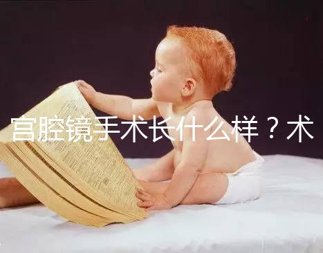 宮腔鏡手術(shù)長什么樣？術(shù)后要注意什么？ ?