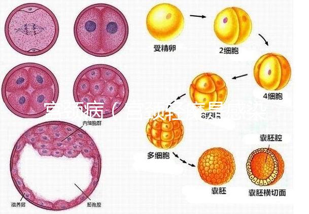 宮頸病（宮頸輕糜是感染了hpv嗎）