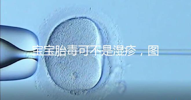 寶寶胎毒可不是濕疹，圖文解讀兩者詳細區別