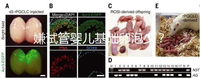 嫌試管嬰兒基礎卵泡少？并非只能食療，這份增多錦囊請收下