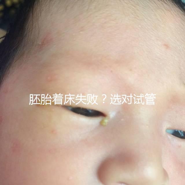 胚胎著床失??？選對試管嬰兒醫生很重要