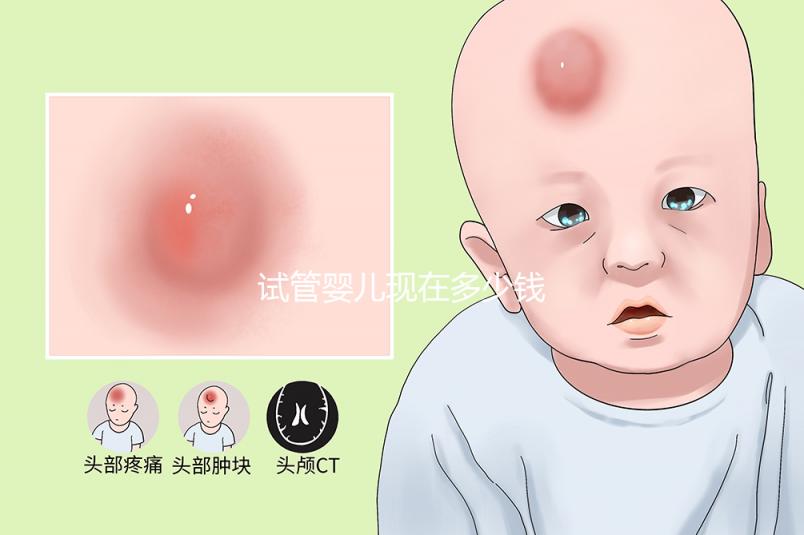 試管嬰兒現(xiàn)在多少錢