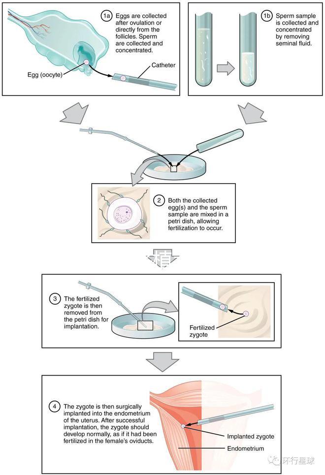試管嬰兒移植手術(shù)（試管嬰兒移植手術(shù)需要多長(zhǎng)時(shí)間）