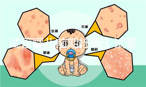 試管嬰兒前期檢查(試管嬰兒前期檢查項目和流程)