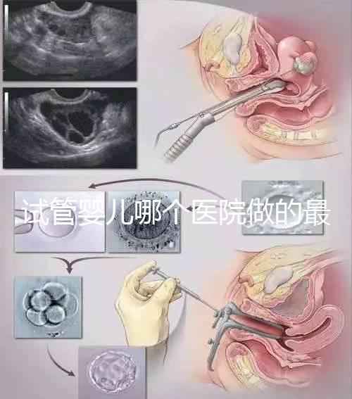 試管嬰兒哪個醫院做的最好呢？多家權威機構推薦