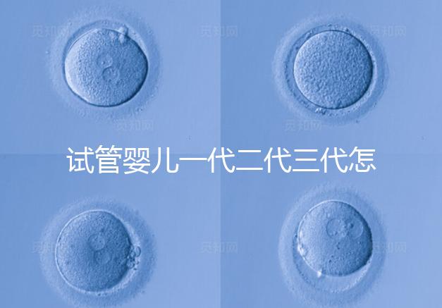 試管嬰兒一代二代三代怎么選?
