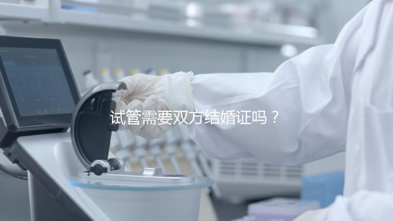 試管需要雙方結(jié)婚證嗎？試管是不是需要結(jié)婚證
