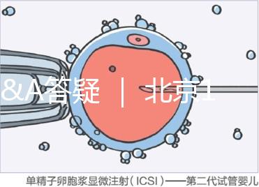 Q&A答疑 | 北京16項輔助生殖技術(shù)進醫(yī)保,試管可以報銷嗎?